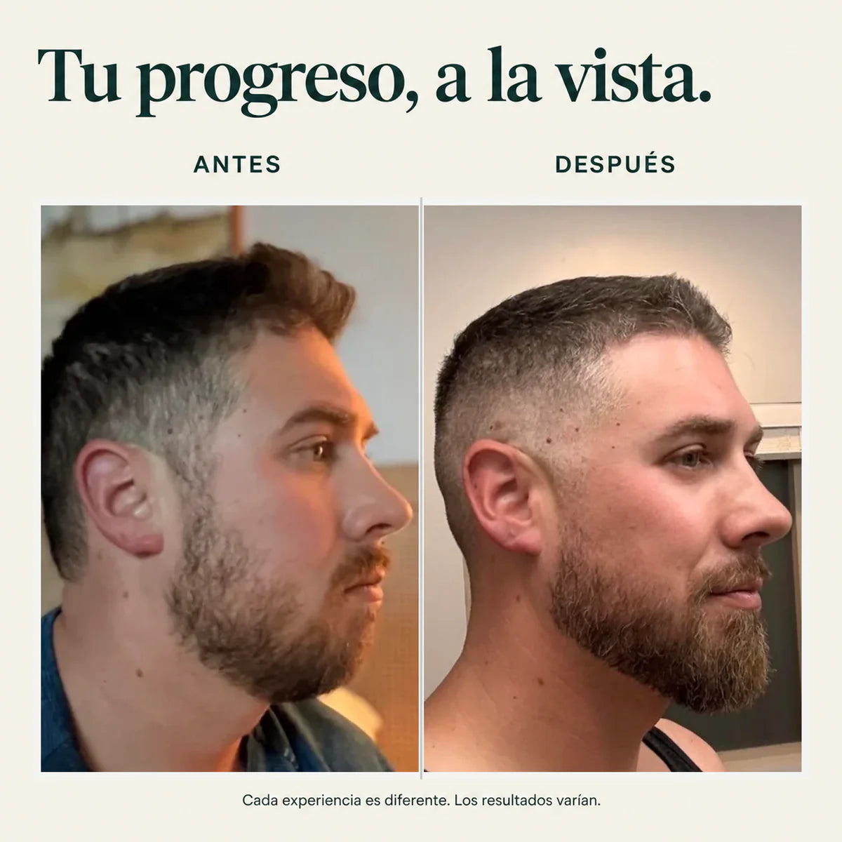 Hair Density Serum with Nanoxidil 5%