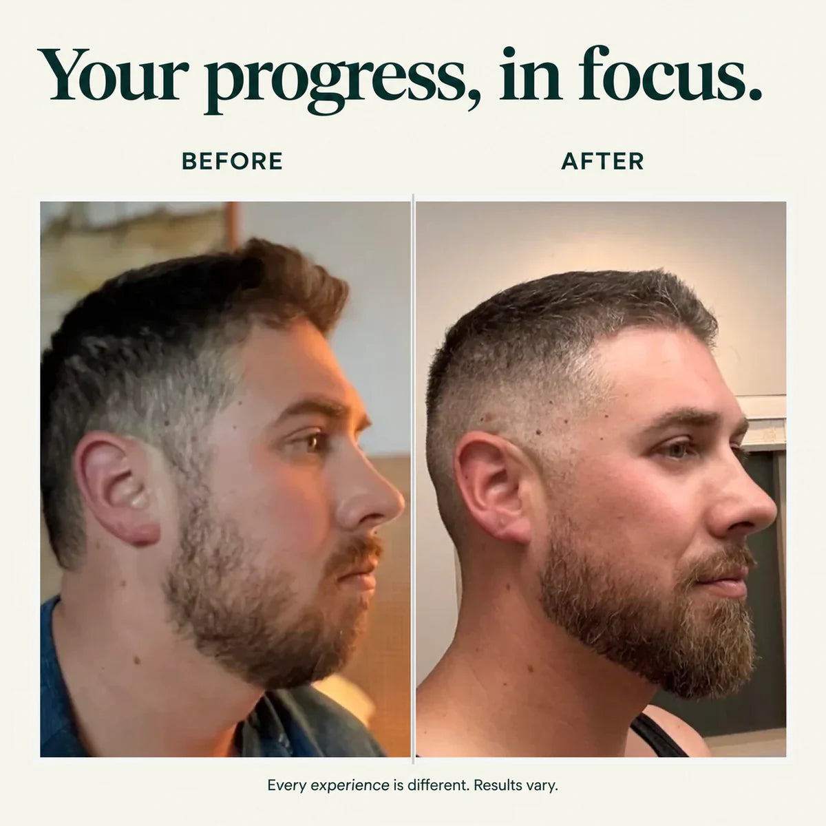 Hair Density Serum with Nanoxidil