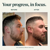 Hair Density Serum with Nanoxidil