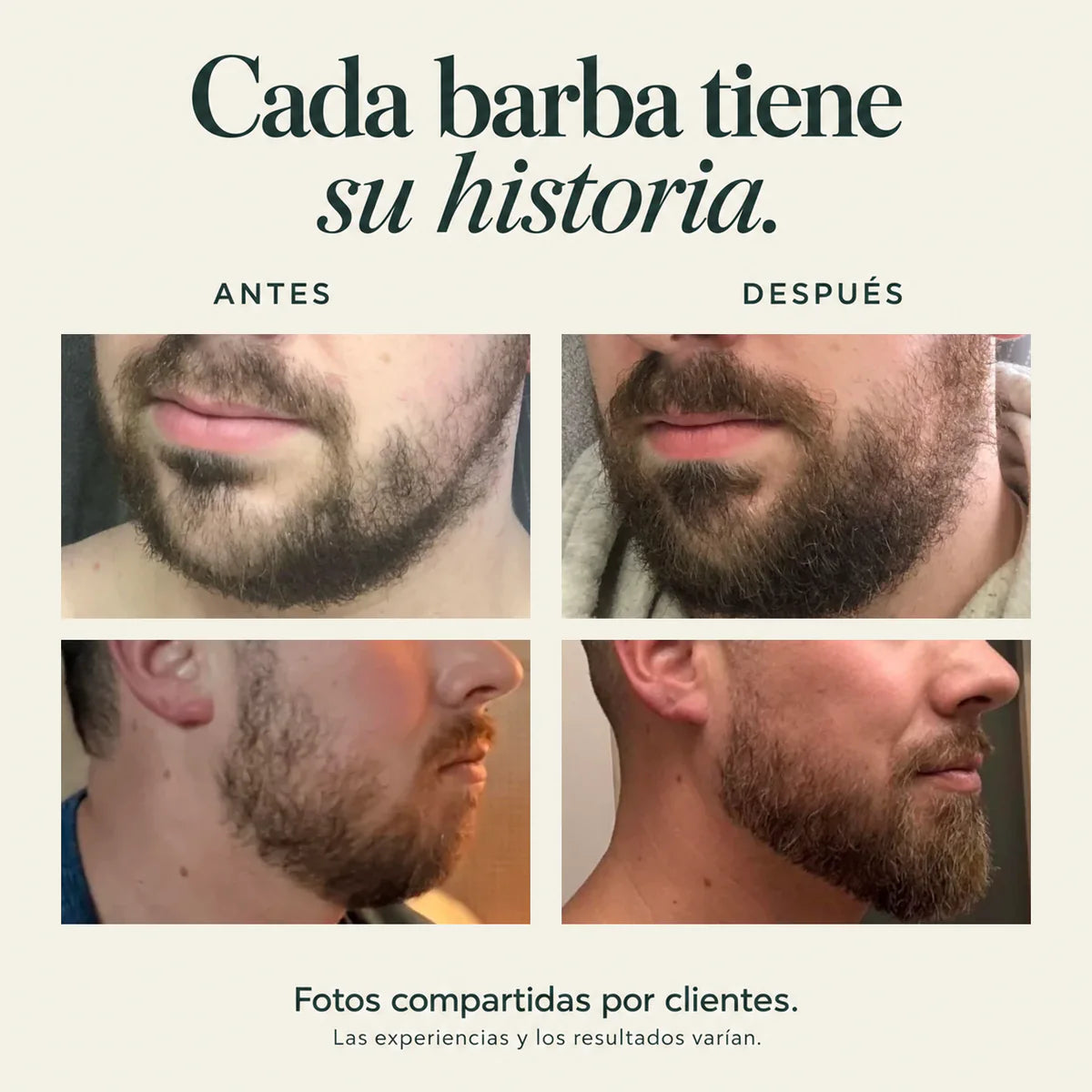 Hair Density Serum with Nanoxidil 5%